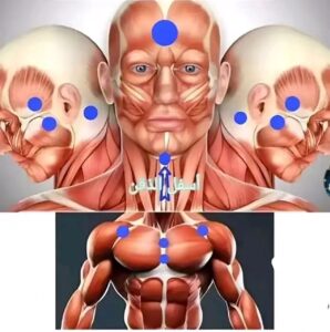 La Hijama contre les douleurs lombaires et cervicales