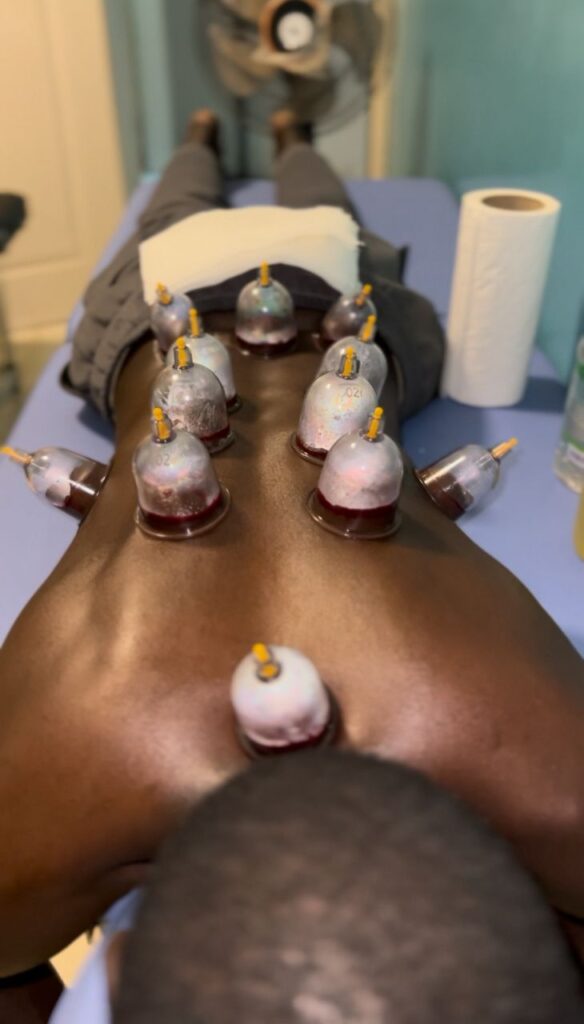 Qu’est-ce que la Hijama